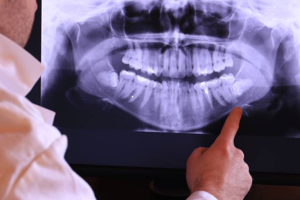 Best Emergency TMJ Treatment in Pine Knoll Shores, NC
